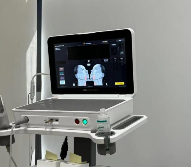 2026韩国超声刀价格表公布!100发、300发、600发多少钱?插图2 2026韩国超声刀价格表公布!100发、300发、600发多少钱?插图2