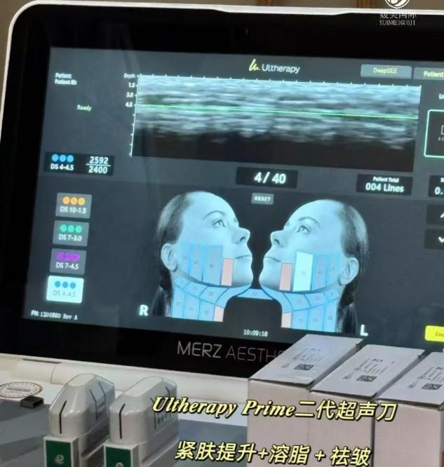 2026韩国超声刀价格表公布!100发、300发、600发多少钱?缩略图 2026韩国超声刀价格表