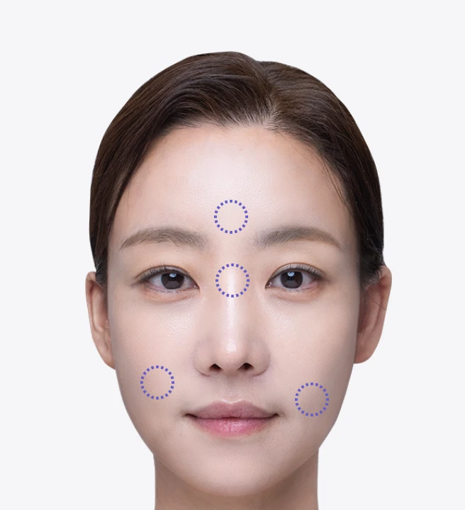 熱瑪吉面部提升效果