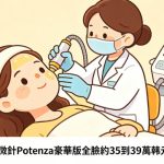 韓國黃金微針Potenza是什麼
